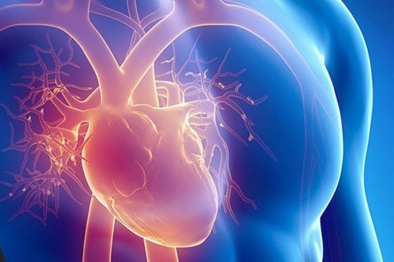 Quais-são-as-doenças-cardiovasculares-mais-comuns